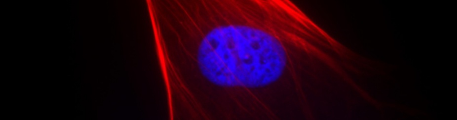 Stem cell in hair follicle. 